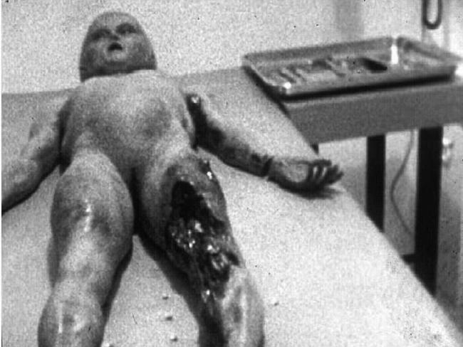 Alien Autopsy Footage: Film-maker Spyros Melaris says he ‘regrets’ hoax