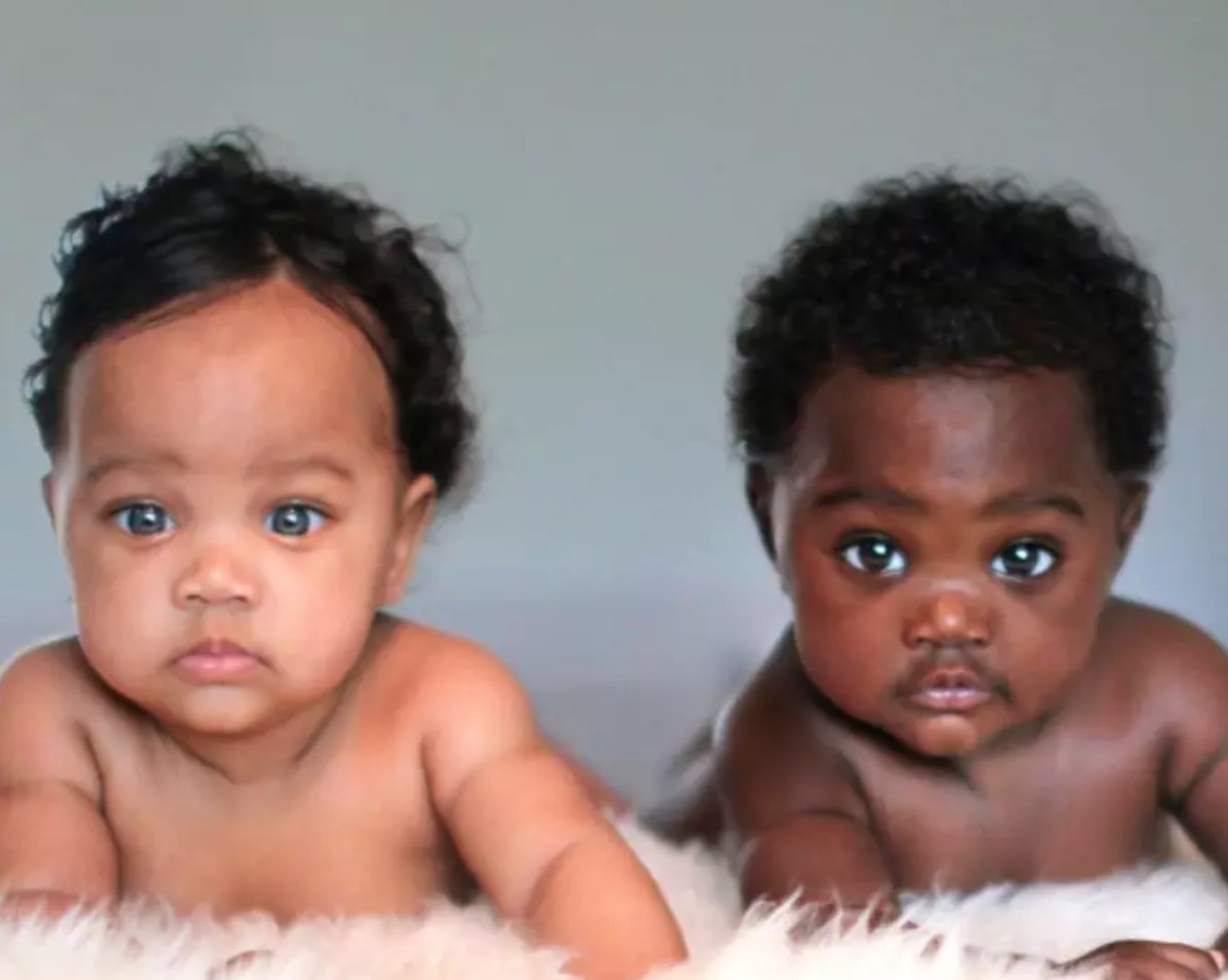 Twin babies with different skin colours have captured the internet’s hearts