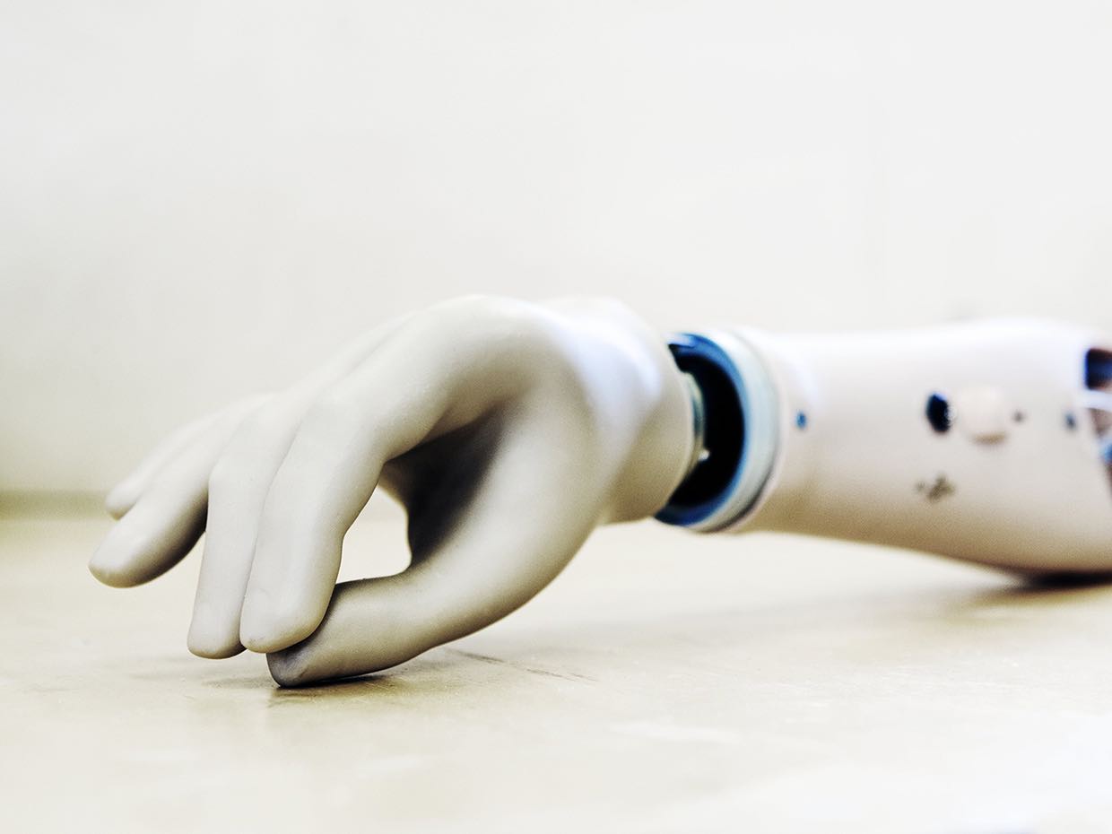 Prosthetic hand feels: Research team that has developed a new prosthetic